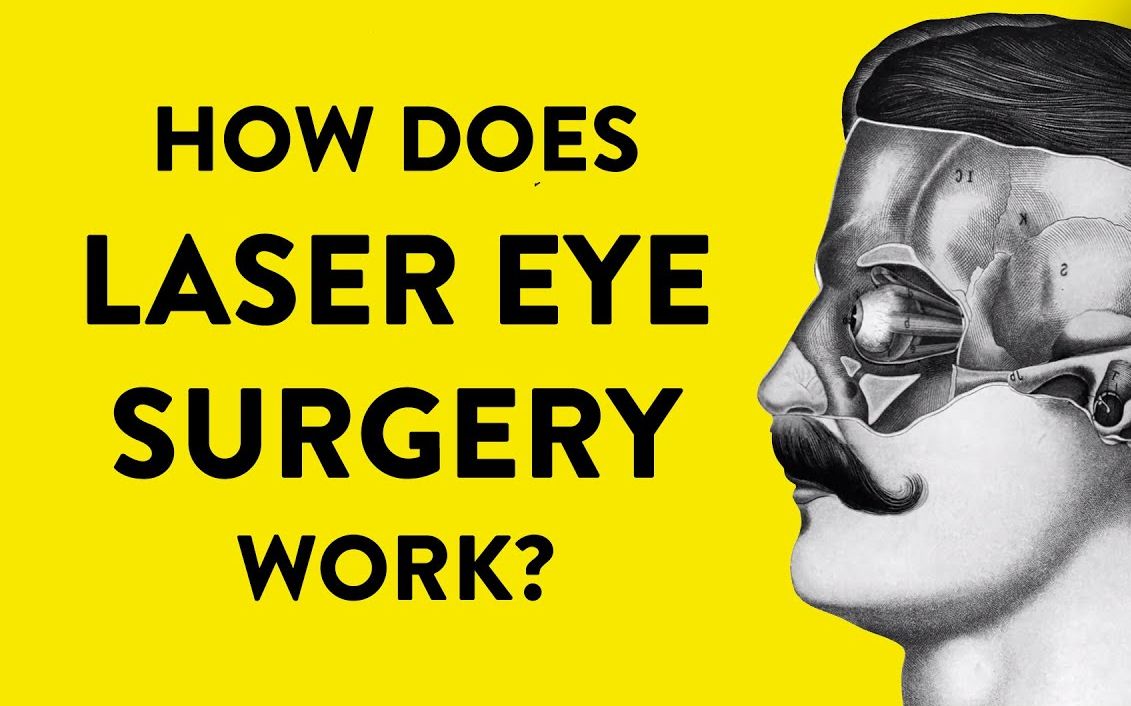 【TED科普】激光眼科手术是如何进行的？